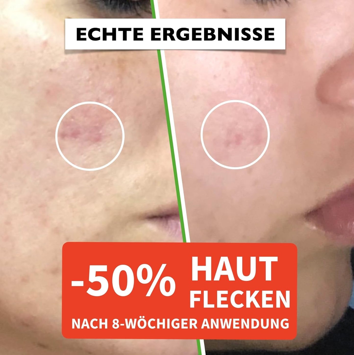 Serum mit Vitamin C 60ml Bio Hyaluron, E. Hochkonzentriert Anti-Falten, Anti-Aging & Dunkle-Flecken. Hyaluronsäure-Gesichtsserum