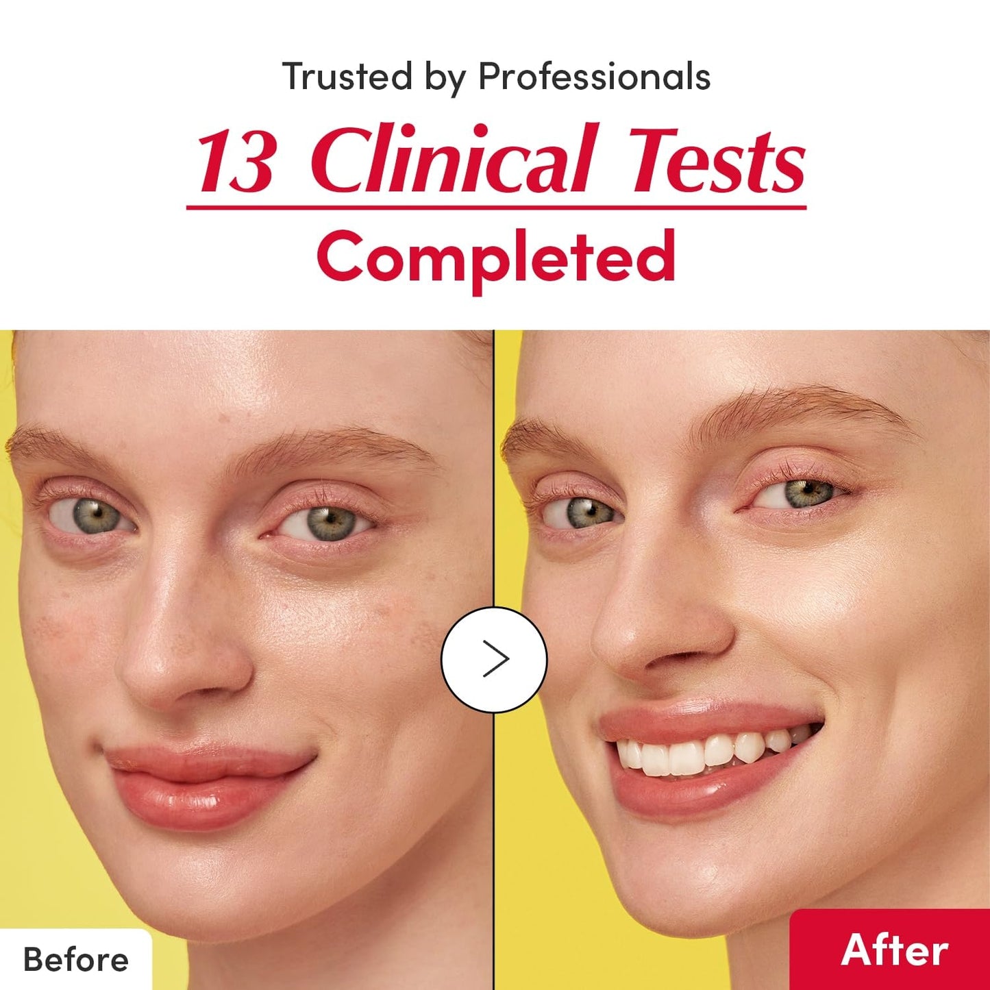 EQQUALBERRY Vitamin C Illuminating Serum - Brightening Serum with Acerola and Niacinamide, Strengthens the Skin Barrier, Moisturises with Ceramide and Hyaluronic Acid, 30 ml